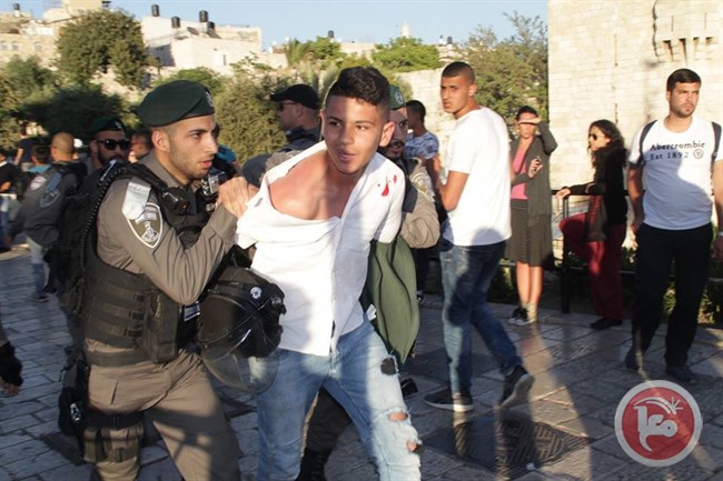 مجروح شدن ۱۳ خبرنگار فلسطینی در حمله پلیس اسرائیل 