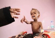 Saudi war on Yemen killed over 3,600 children, paralyzed 800
