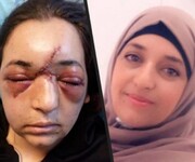 Israeli troop breaks Palestinian woman’s skull