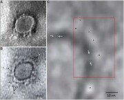 سائنسدانوں نے کورونا وائرس کی پہلی تصویر قید کر لی