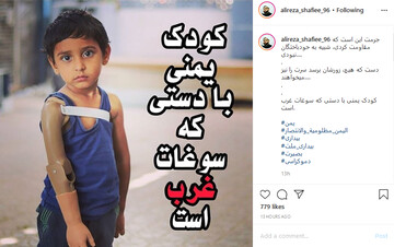 کودک یمنی با دستی که سوغات غرب است