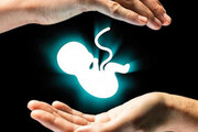 تبیین ابعاد فقهی سقط جنین و پیشنهادات تقنینی مربوط به آن