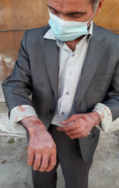 ضرب و شتم آمر به معروف این بار توسط مدیر دفتر پیشخوان دولت! + عکس