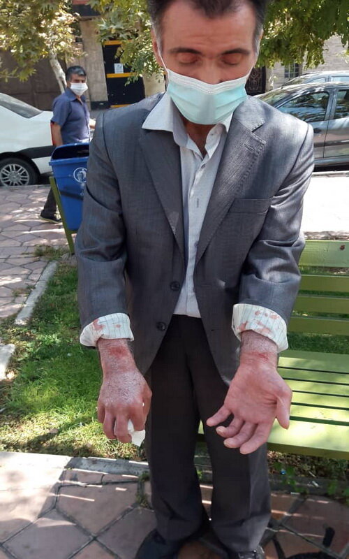ضرب و شتم آمر به معروف این بار توسط مدیر دفتر پیشخوان دولت! + عکس
