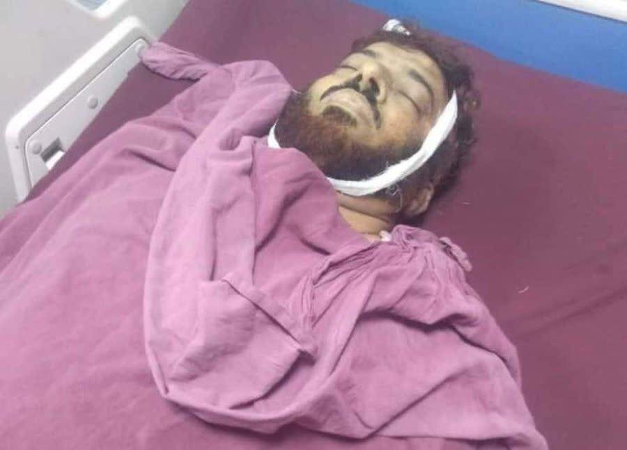 پشاور میں نماز جمعہ کے دوران ہونے والے دھماکے میں علامہ ارشاد حسین خلیلی شہید ہو گئے