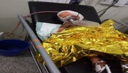 إصابة ثلاثة أطفال يمنيين بانفجار قنبلة من مخلفات العدوان في حجة