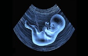بچه‌ام را سقط کرده‌ام، دیه‌اش چقدر است؟/ چه کسی باید دیه بدهد؟