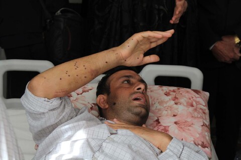 تصاویر / عیادت امام جمعه همدان از یکی از مجروحان فراجا در اغتشاشات اخیر