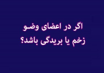 احکام شرعی | شیوه وضو گرفتن با وجود زخم در اعضای وضو