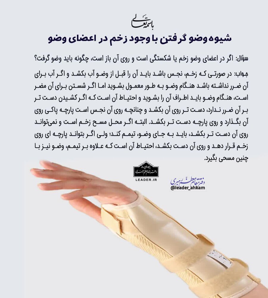 احکام شرعی | شیوه وضو گرفتن با وجود زخم در اعضای وضو