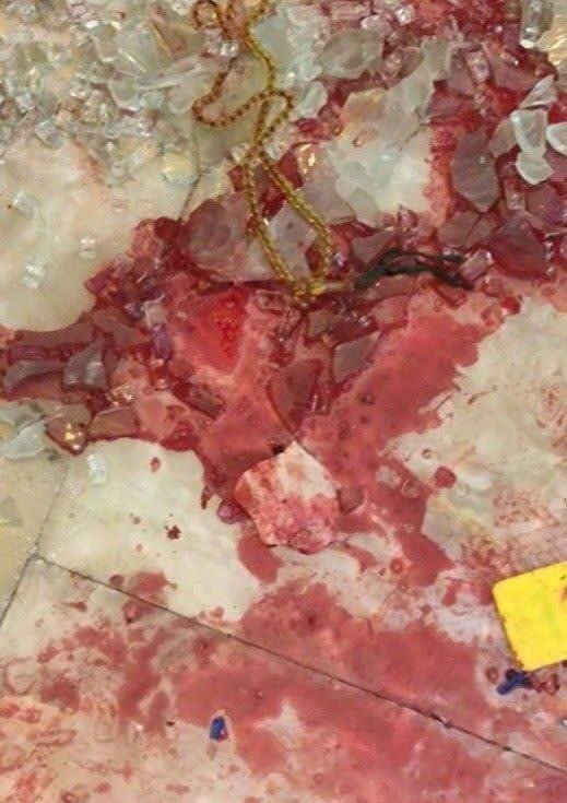 عکس: اولین تصاویر از حمله تروریستی حرم شاهچراغ(ع)