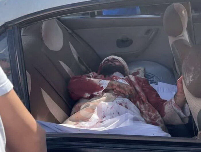 نماینده آیت الله اعرافی به منزل روحانی مجروح اغتشاشات رفت + عکس