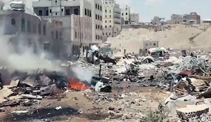 إصابة مواطن يمني بانفجار جسم من مخلفات العدوان في الجوف إصابة مواطن يمني بانفجار جسم من مخلفات العدوان في الجوف