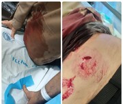ईरान के गिलान प्रांत मे धार्मिक छात्र पर हमला / नही अनिल-मुनकर का सिला चाकू से मिला