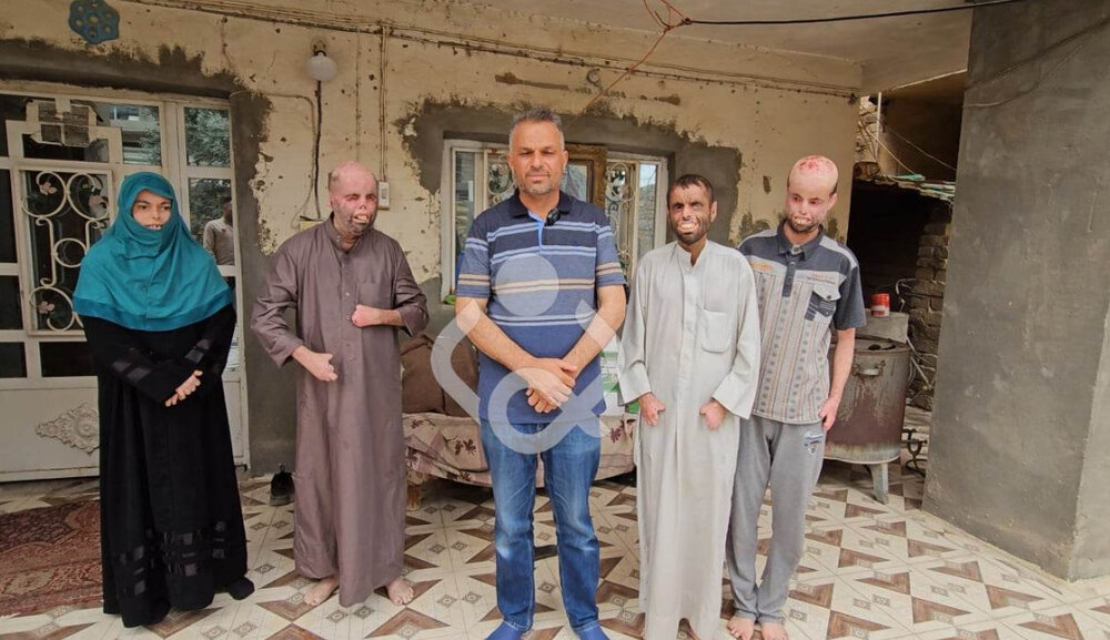 خانواده مبتلا به بیماری شدید پوستی تحت حمایت درمانی حرم امام حسین(ع) قرار گرفت