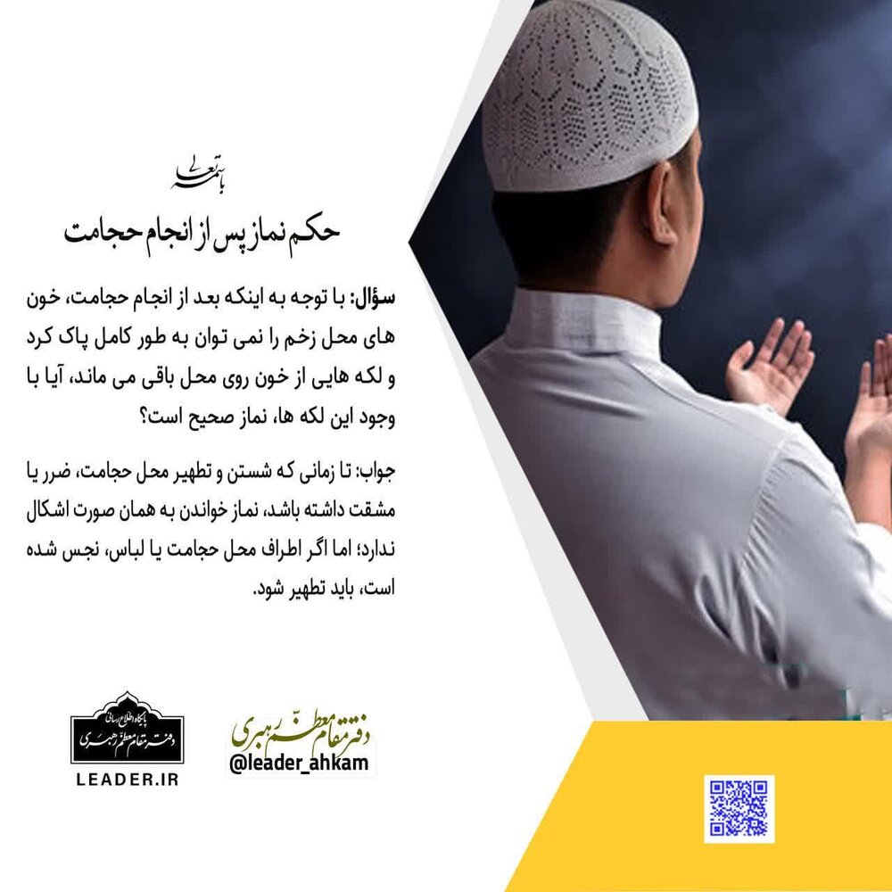 احکام شرعی | حکم نماز پس از حجامت