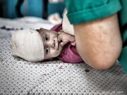 تصاویر/ غزہ کی پٹی کے جنوبی علاقے خان یونس پر اسرائیل کے حالیہ حملوں میں زخمی بچے