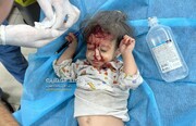 تصاویر/ غزہ پٹی کے جنوب میں  اسرائیل کی بمباری میں زخمی بچے