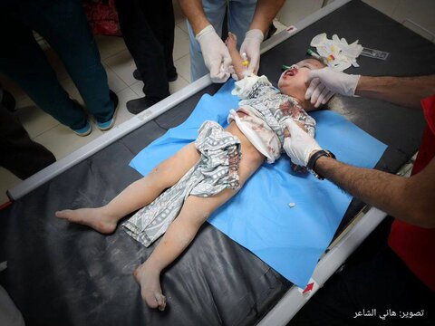 کودکان مجروح در بمباران خان یونس (جنوب نوار غزه)