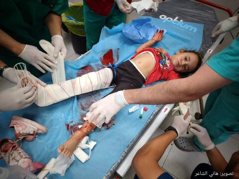 کودکان مجروح در بمباران خان یونس (جنوب نوار غزه)