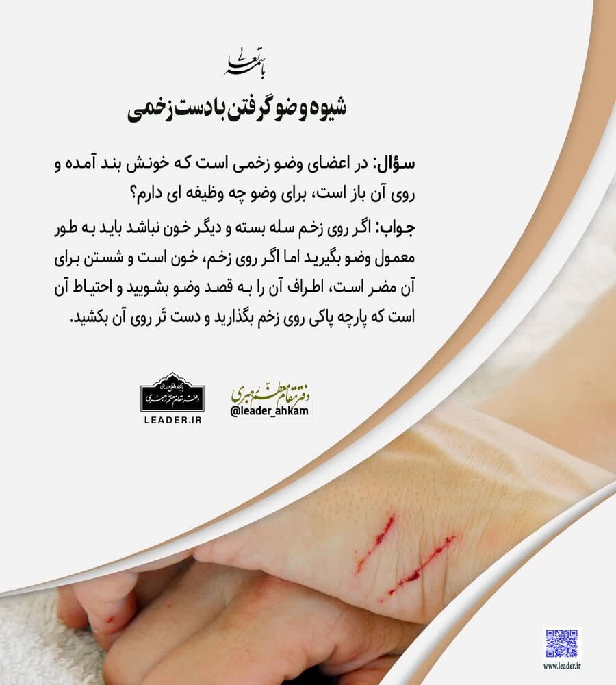 احکام شرعی | شیوه وضو گرفتن با دست زخمی