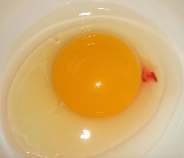 Blood seen in the yolk or the white part of the egg