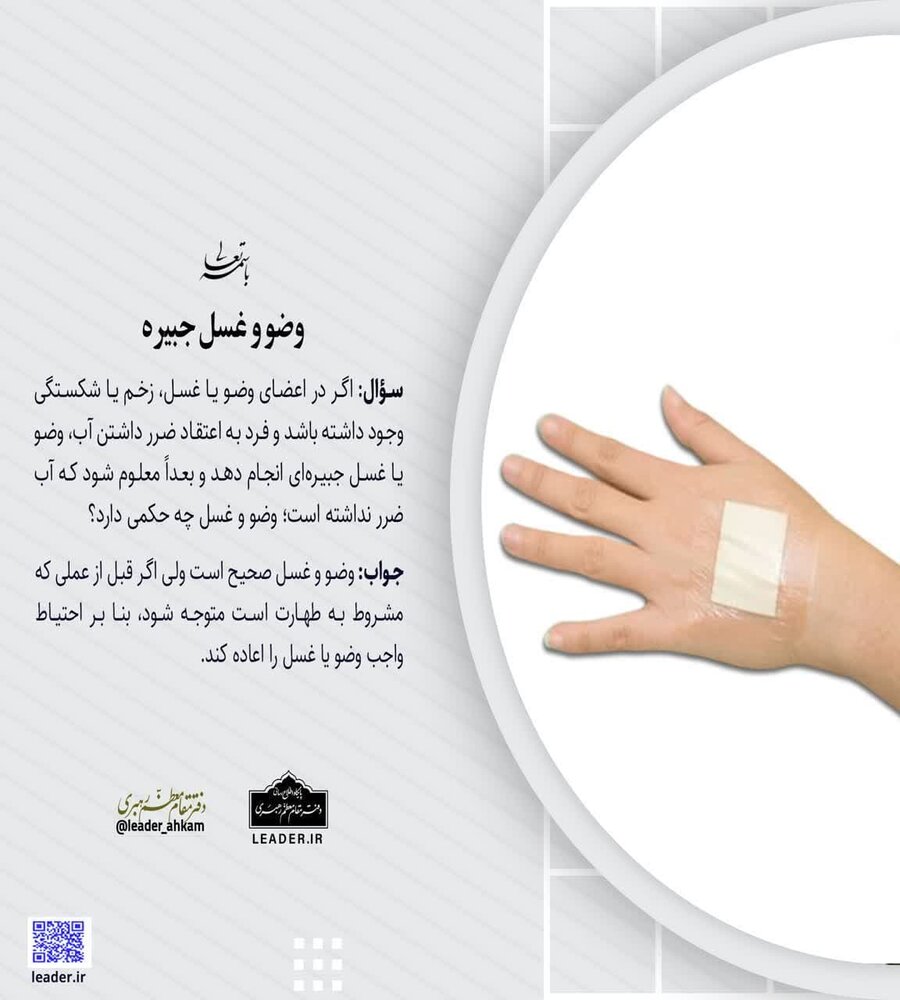 احکام شرعی | وضو و غسل جبیره