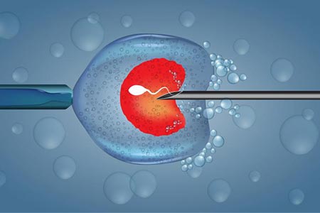 The inheritance of "the born child through implanting sperm"