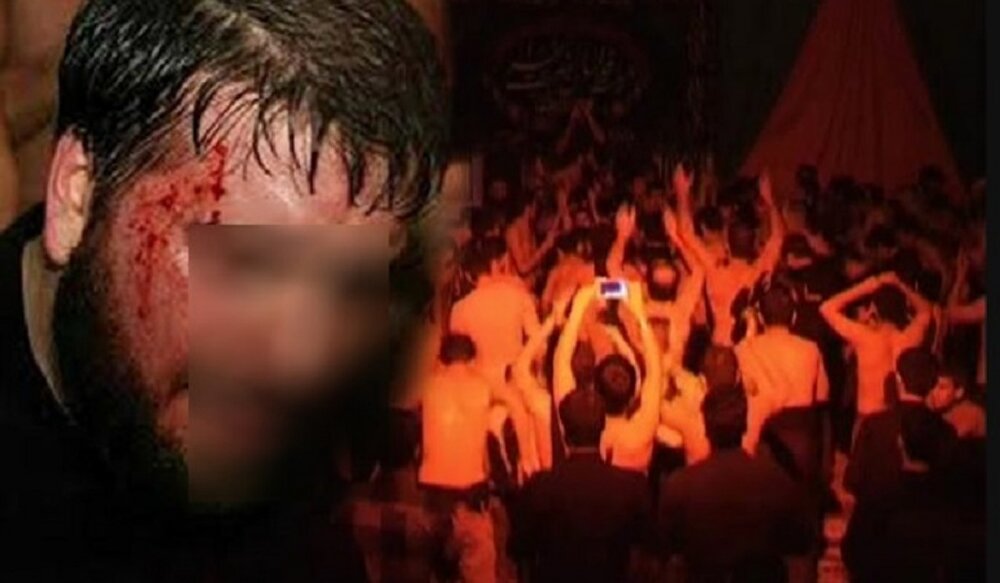 احکام شرعی | لطمه‌زنی در عزاداری امام حسین(ع)