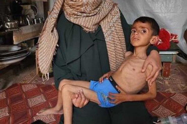 یادداشت | سکوت جایز نیست؛ فریاد غزه را بشنوید