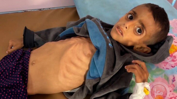 गाज़ा में भूख से 14 और लोगों की मौत, बच्चों की हालत नाजुक गाज़ा में भूख से 14 और लोगों की मौत, बच्चों की हालत नाजुक