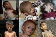 ग़ज़्ज़ा में मानवीय संकट: रोज़ाना 28 बच्चे जान गंवा रहे हैं