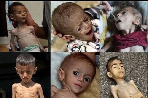 یورپی کمیشن: غزہ کے 6 لاکھ سے زائد افراد قحط کے خطرے میں