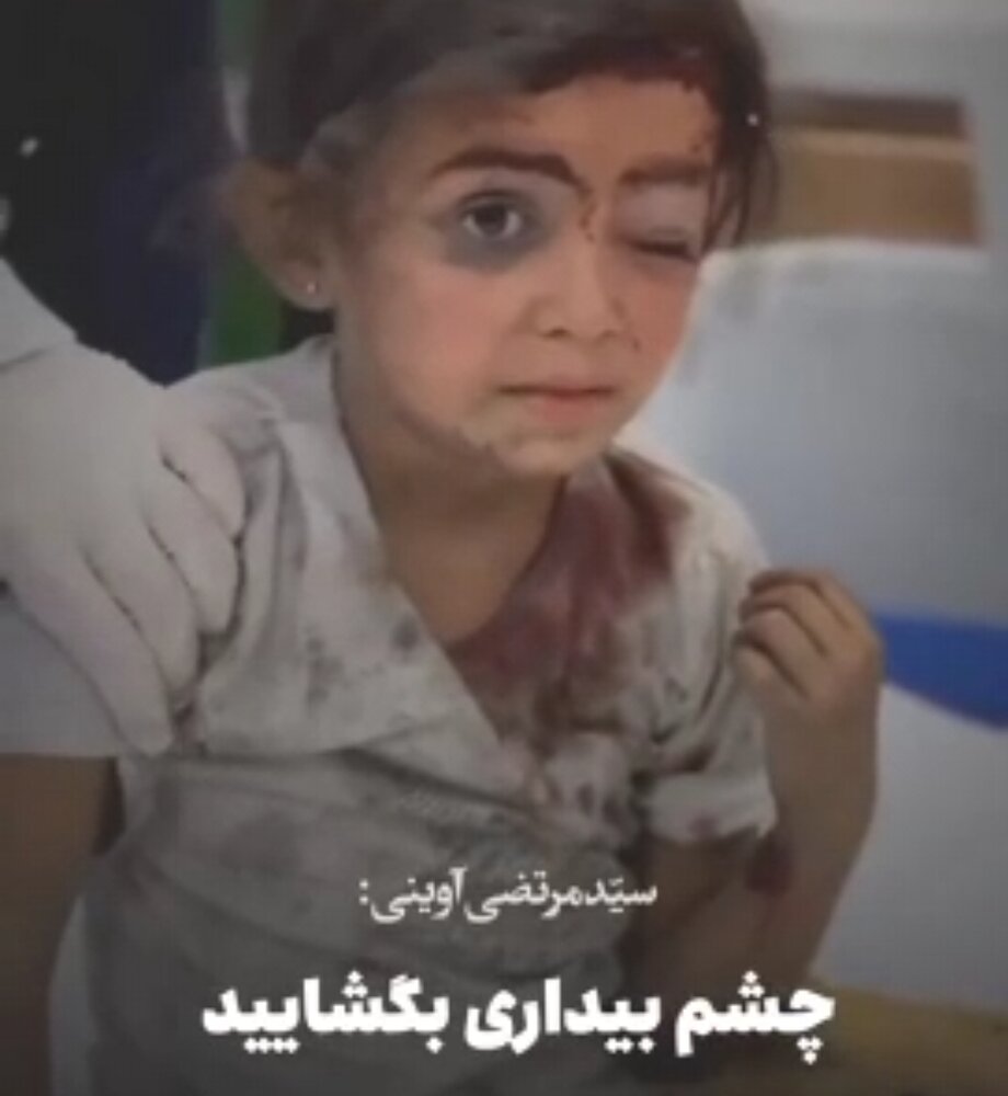 فیلم | ای وجدان های نیم خفته،چشم بیداری بگشایید