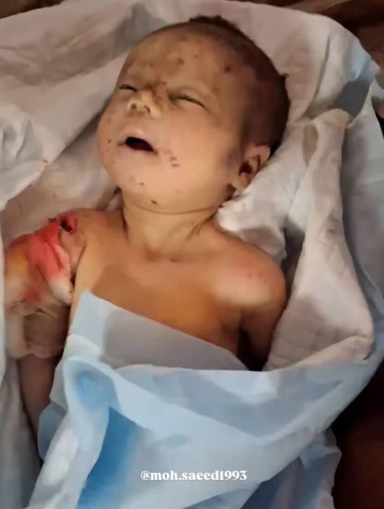 روزهای سخت مردم غزه و قدس اشغالی در سایه آتش بس شکننده/ زیر ساخت‌های مسجدالاقصی در حال فروپاشی است+ویدیو و عکس