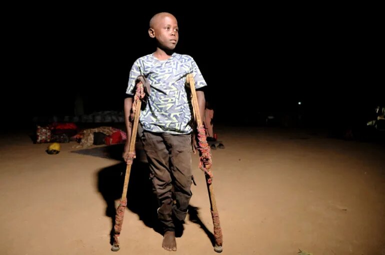 مصطفی، کودکی که پایش را در بمباران توپخانه‌ای نیروهای "الدعم السریع" از دست داده است، در اردوگاهی برای آوارگان در الدبه، شمال سودان، ایستاده است.