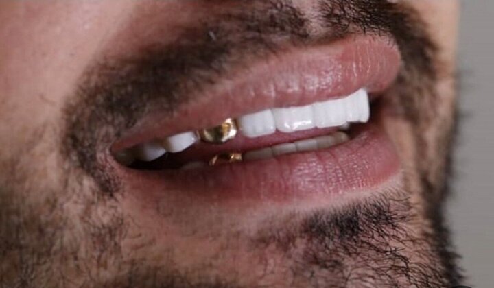 احکام شرعی | کیا مردوں کی نماز سونے کے دانت (گولڈ کیپ) کے ساتھ صحیح ہے؟