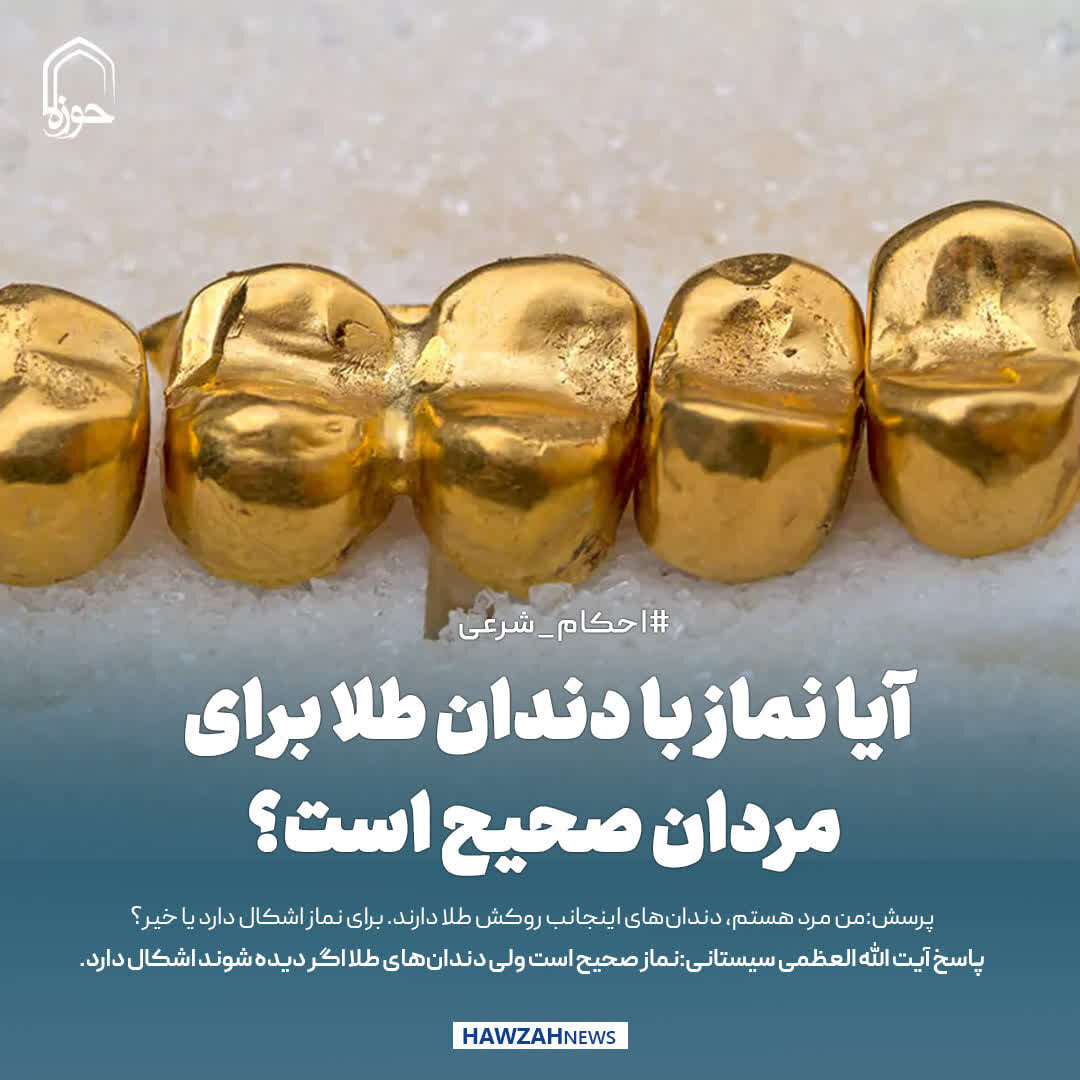 عکس نوشت| آیا نماز با دندان طلا برای مردان صحیح است؟