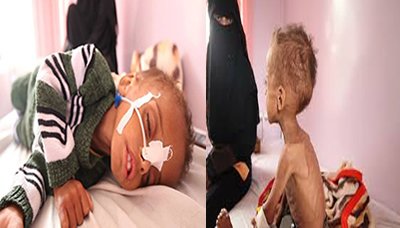 الحالة الإنسانية والمعيشية في اليمن