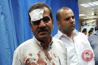 Israeli forces injure 4 Palestinians, 1 critically, in clashes south of Nablus