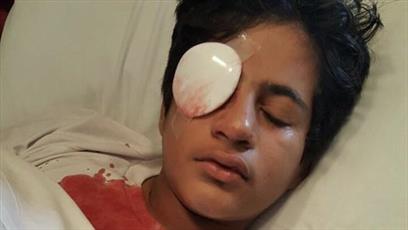 Bahraini forces injure teenager in anti-regime rally